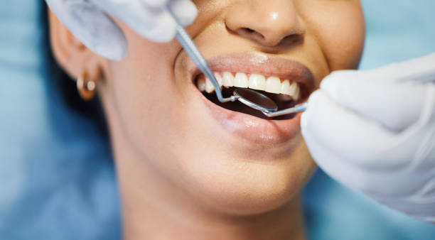 Best Dentist for Tooth Abscess  in Oak Hill, TN