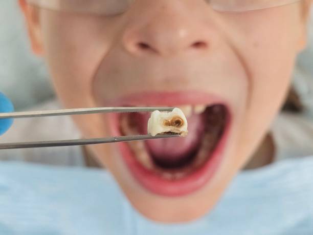 Best Dentist for Severe Toothache  in Oak Hill, TN